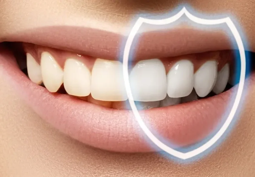 Восстановление зуба под ортопедическую конструкцию