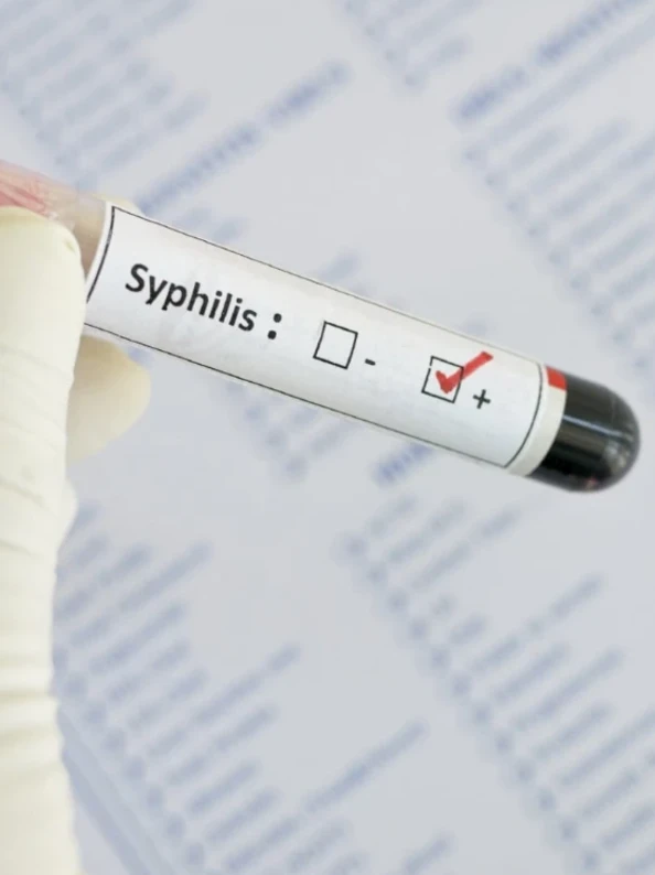 
RW (экспресс-реакция, РПГА)