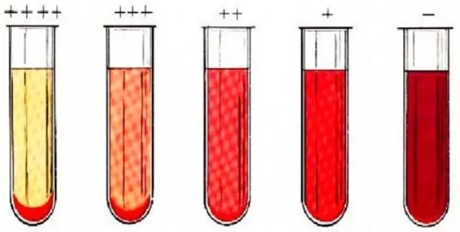 Анализ крови на сифилис (RW)