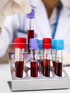 Исследование на паразитов